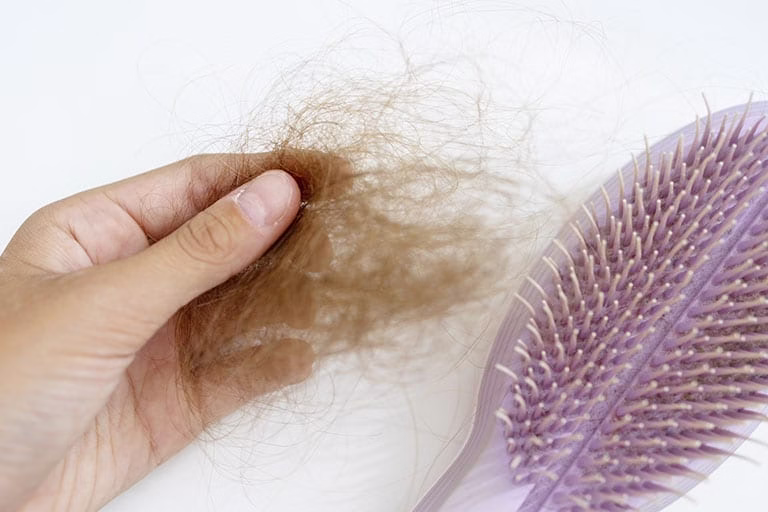 Caida de pelo mujer soluciones - Causas, prevención y remedios