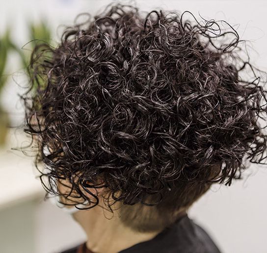 protesis-capilar-despues2